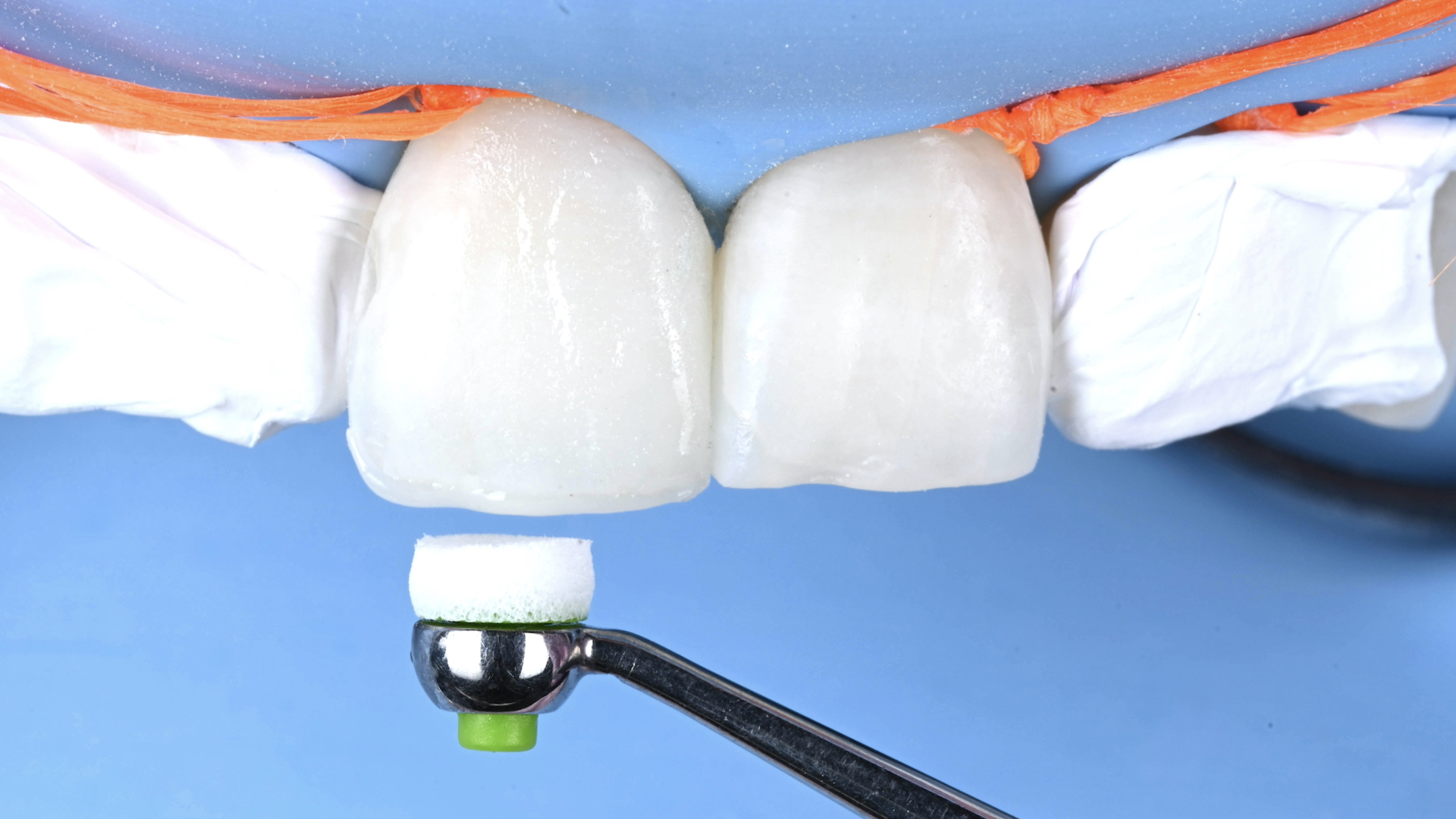 Polishing an anterior composite